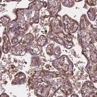 Immunohistochemical staining of human placenta shows strong positivity in cytoplasm granular in trophoblastic cells.