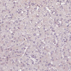 Immunohistochemical staining of human liver shows no positivity in hepatocytes as expected.