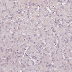 Immunohistochemical staining of human liver shows no positivity in hepatocytes as expected.
