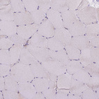Immunohistochemical staining of human skeletal muscle shows negative cytoplasmic positivity in myocytes as expected.