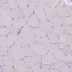 Immunohistochemical staining of human skeletal muscle shows negative cytoplasmic positivity in myocytes as expected.
