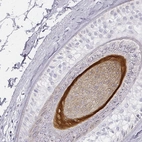 Immunohistochemical staining of human skin shows strong cytoplasmic positivity in hair follicle.