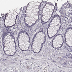 Immunohistochemical staining of human colon shows no positivity in glandular cells as expected.