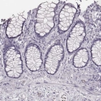 Immunohistochemical staining of human colon shows no positivity in glandular cells as expected.