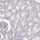 Immunohistochemical staining of human kidney shows no positivity in cells in tubules as expected.
