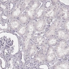 Immunohistochemical staining of human kidney shows no positivity in cells in tubules as expected.