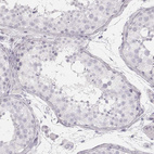 Immunohistochemical staining of human testis shows no positivity in cells in seminiferous ducts as expected.