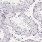Immunohistochemical staining of human testis shows no positivity in cells in seminiferous ducts as expected.