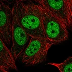 Immunofluorescent staining of human cell line MCF7 shows localization to nucleoplasm.