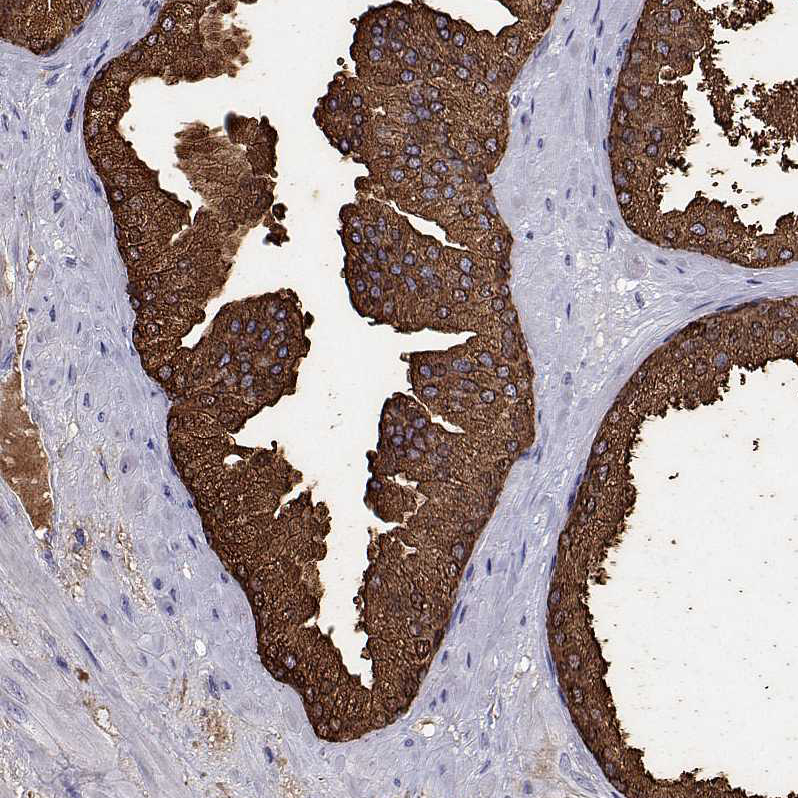 Anti-UMODL1 Antibody