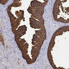 Anti-UMODL1 Antibody