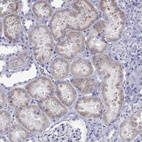 Immunohistochemical staining of human Kidney shows very weak cytoplasmic positivity in cells in tubules.