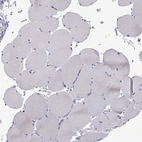 Immunohistochemical staining of human Skeletal muscle shows no cytoplasmic positivity in myocytes as expected.