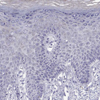 Immunohistochemical staining of human Skin shows no cytoplasmic positivity in squamous epithelial cells as expected.