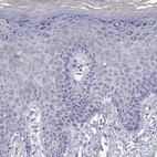 Immunohistochemical staining of human Skin shows no cytoplasmic positivity in squamous epithelial cells as expected.