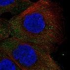 Anti-TSPY1 Antibody