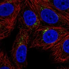 Anti-SPPL2A Antibody