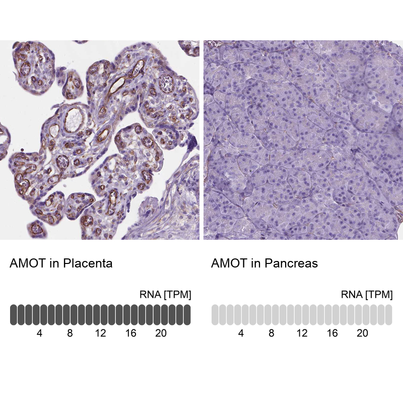 Anti-AMOT Antibody