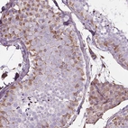 Immunohistochemical staining of human testis shows moderate cytoplasmic positivity in cells in seminiferous ducts.