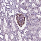 Immunohistochemical staining of human kidney shows strong membranous positivity in cells in glomeruli.