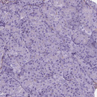 Immunohistochemical staining of human pancreas shows no positivity in exocrine glandular cells as expected.