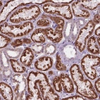 Anti-C18orf21 Antibody