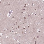 Anti-ISLR2 Antibody