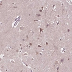 Anti-ISLR2 Antibody