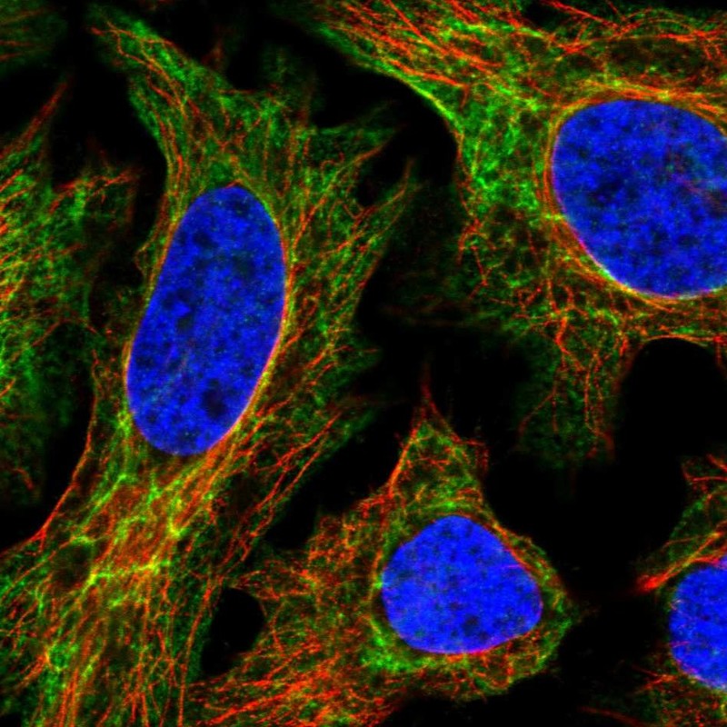 Anti-EPPK1 Antibody