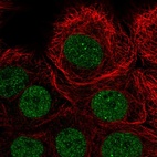 Anti-PIAS3 Antibody