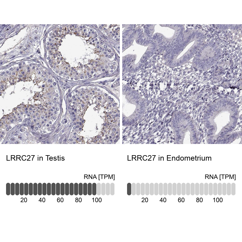 Anti-LRRC27 Antibody