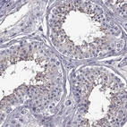Immunohistochemical staining of human testis shows high expression.