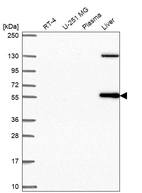 Western blot analysis in human cell line RT-4, human cell line U-251 MG, human plasma and human liver tissue.