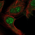 Anti-RGS12 Antibody