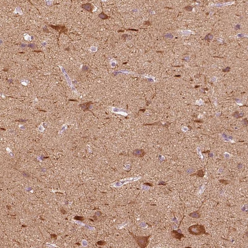 Anti-C20orf194 Antibody