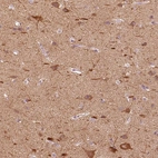 Anti-C20orf194 Antibody