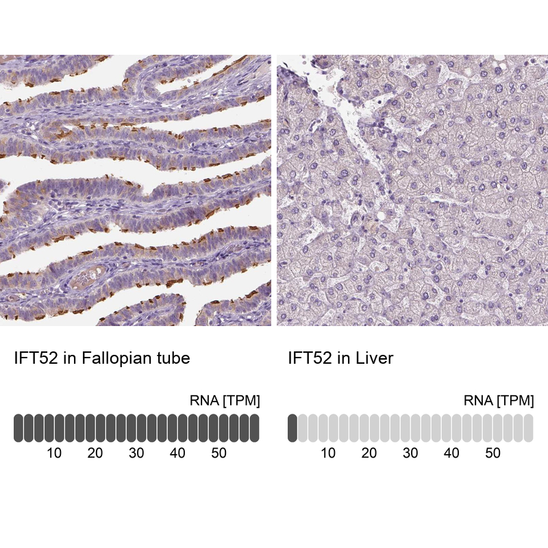 Anti-IFT52 Antibody