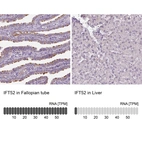 Anti-IFT52 Antibody