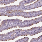 Immunohistochemical staining of human fallopian tube shows high expression.
