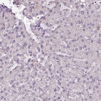 Anti-IFT52 Antibody
