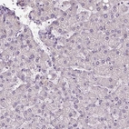 Immunohistochemical staining of human liver shows low expression as expected.