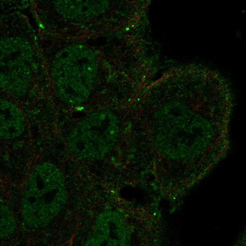 Anti-NOTCH3 Antibody