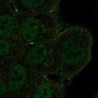 Anti-NOTCH3 Antibody