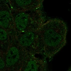 Anti-NOTCH3 Antibody