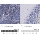 Anti-FYB1 Antibody