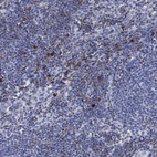 Immunohistochemical staining of human lymph node shows high expression.
