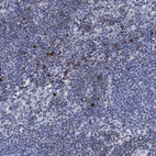 Immunohistochemical staining of human lymph node shows high expression.
