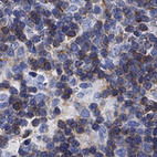 Immunohistochemical staining of human thymus shows cytoplasmic positivity in medullary cells.
