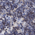 Immunohistochemical staining of human thymus shows cytoplasmic positivity in medullary cells.
