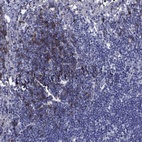Immunohistochemical staining of human lymph node shows high expression.